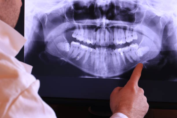 Best Emergency Root Canal Treatment in University Park, TX