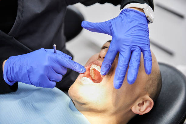 Best Emergency Dentist for Lost Fillings or Crowns in University Park, TX